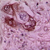 Anti-Laminin gamma 1 Antibody