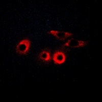 Anti-Laminin gamma 1 Antibody