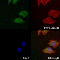 Anti-LIF Antibody