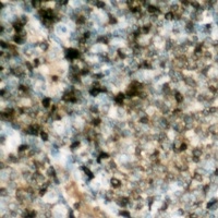 HSL (Phospho-S552) Antibody