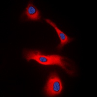 LT beta antibody