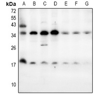 LY6E Antibody
