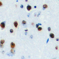 Anti-LYL1 Antibody