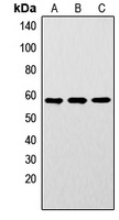 LYN (Phospho-Y192) Antibody