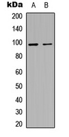 MACC1 Antibody