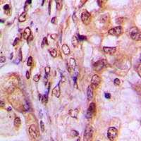 Anti-MAF1 Antibody