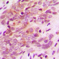Anti-MAGEA9 Antibody