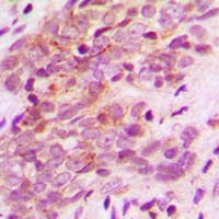 MAGEA9 antibody