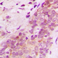 Anti-AIP-1 Antibody