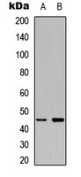 MKK1 Rabbit Polyclonal Antibody
