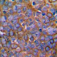 MKK1 Rabbit Polyclonal Antibody