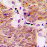 Anti-MEKK1 (Phospho-T1402) Antibody