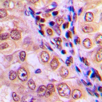 MEKK4 Antibody
