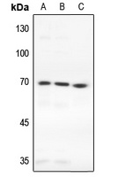 TAK1 Rabbit Polyclonal Antibody