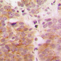 TAK1 Rabbit Polyclonal Antibody
