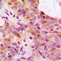 Anti-TAU (Phospho-S673) Antibody