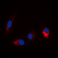 Anti-TAU (Phospho-S673) Antibody