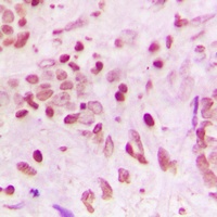 Anti-ZNF608 Antibody