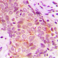 Anti-MARK3 Antibody