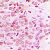 TRAP230 Rabbit Polyclonal Antibody