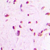 Anti-MEF2C Antibody