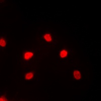Anti-MEF2C Antibody