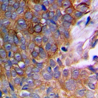 Anti-MMP10 Antibody