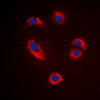 Anti-MMP10 Antibody