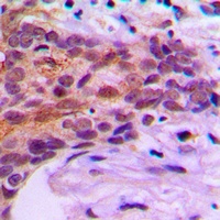 Anti-MOB1B Antibody