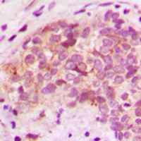 Anti-BRP44L Antibody