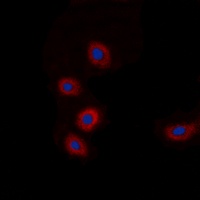 Anti-BRP44L Antibody