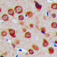 Anti-MRPS5 Antibody