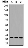 CD20 Rabbit Polyclonal Antibody
