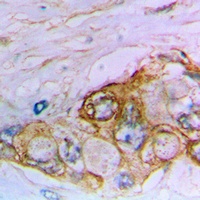 Anti-MUC16 Antibody