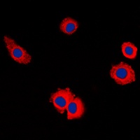 Anti-MUC16 Antibody