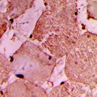 Anti-IDOL Antibody