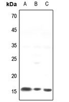 NCALD Antibody