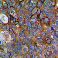 Anti-NCALD Antibody