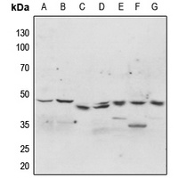 p47 phox (Phospho-S304) Antibody