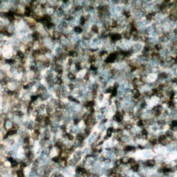 p47 phox (Phospho-S304) Antibody