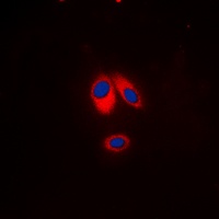 Anti-p47 phox (Phospho-S359) Antibody