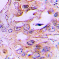 Anti-NDRG2 Antibody