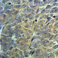 Anti-NDUFA1 Antibody