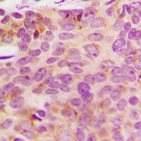 Anti-NDUFA3 Antibody