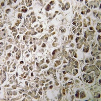 Anti-NDUFB1 Antibody