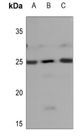 NDUFB9 Antibody