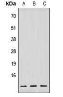 NDUFV3 Antibody
