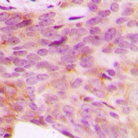 Anti-NDUFV3 Antibody