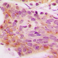 Anti-NFAT4 (Phospho-S165) Antibody