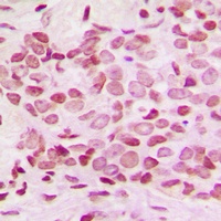 Anti-NF-kappaB p100 (Phospho-S865) Antibody